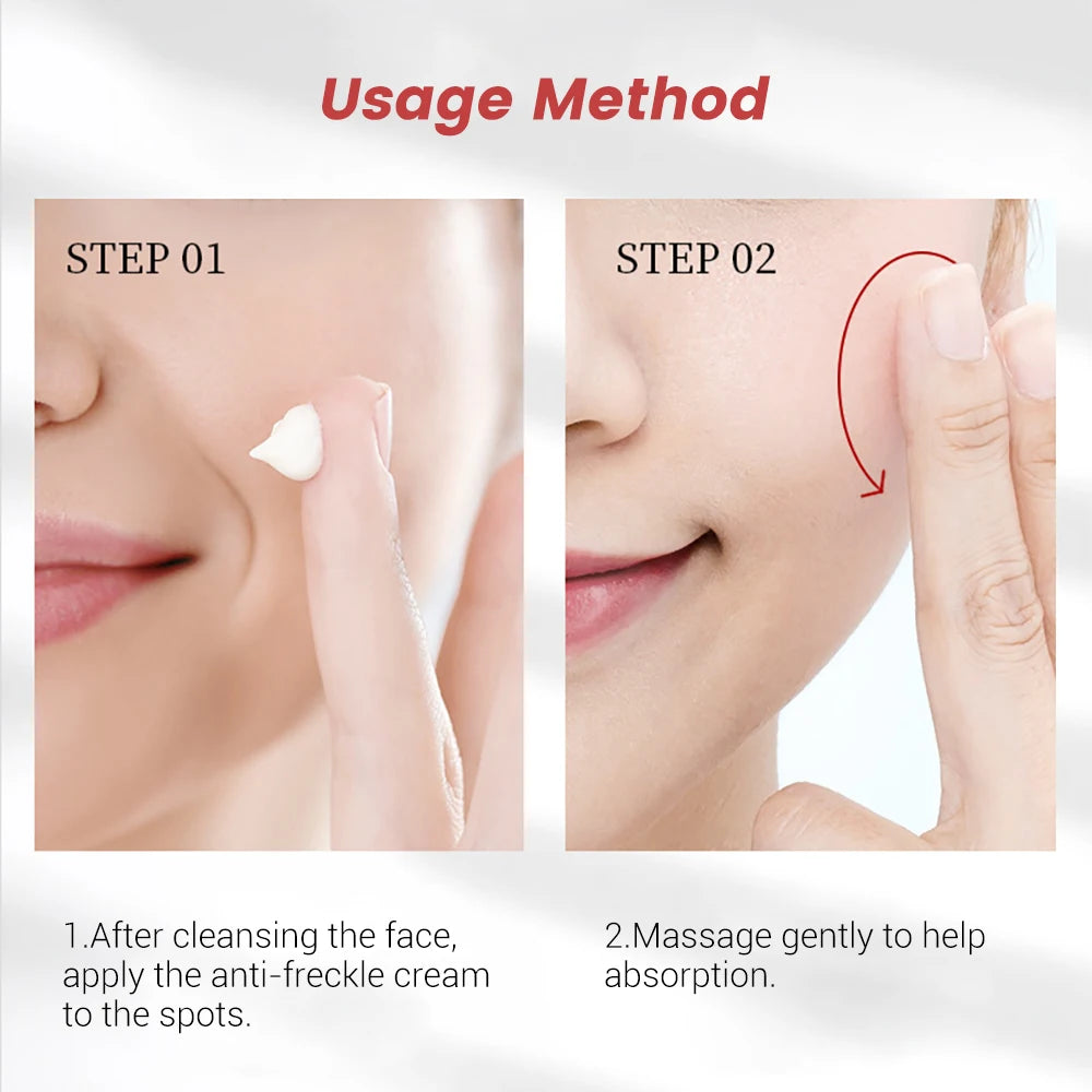 20g Whitening Freckle Cream Remove Dark Spot Cream Anti Freckle and Aging Cream Fade Pigmentation Melasma Brighten Serum Skin-usashopcenter.com