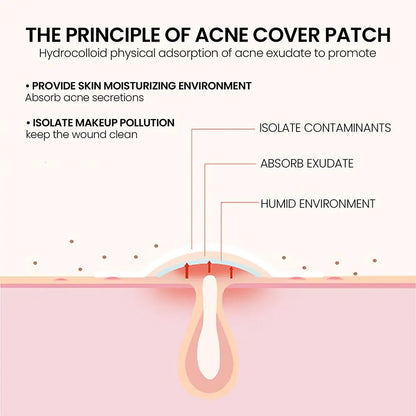 200pcs/set Invisible Acne Pimple Patch Professional Face Skin Care Repair Acne Healing Absorbing Spot Sticker For Men Women