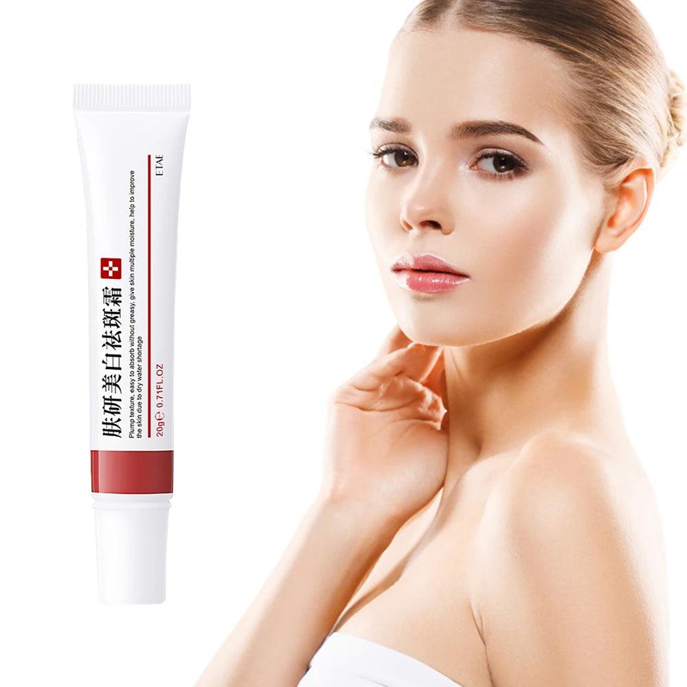 20g Whitening Freckle Cream Remove Dark Spot Cream Anti Freckle and Aging Cream Fade Pigmentation Melasma Brighten Serum Skin-usashopcenter.com