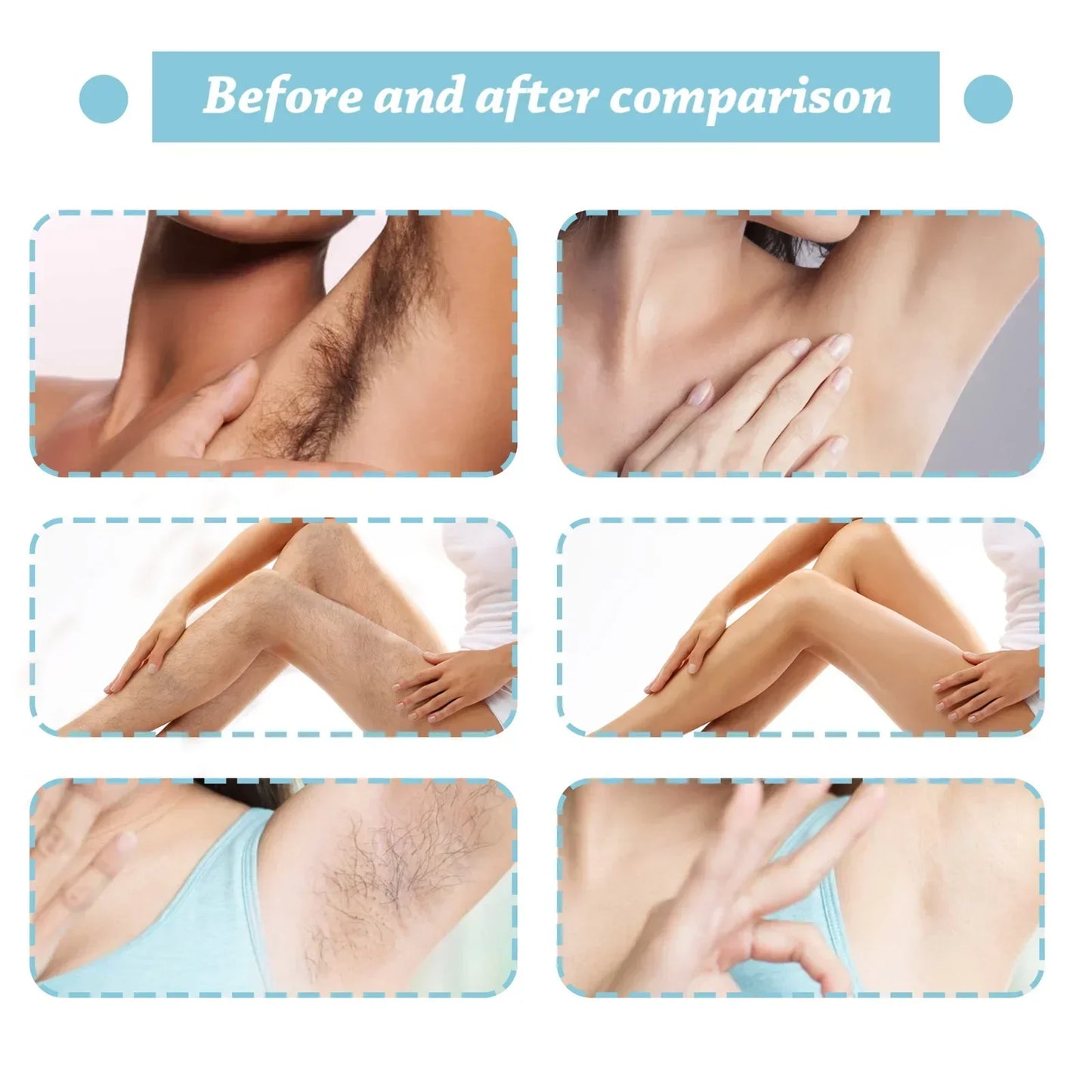 Permanent Hair Removal Spray